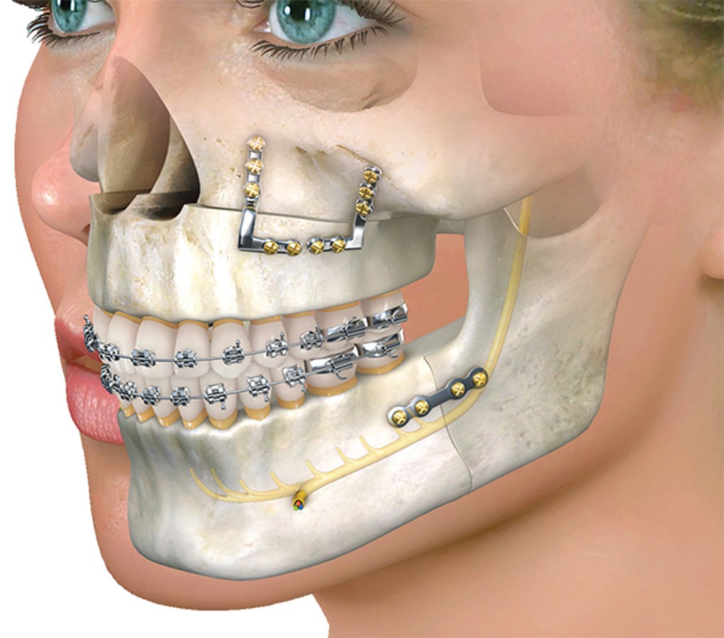 Oral and maxillofacial surgery Photo
